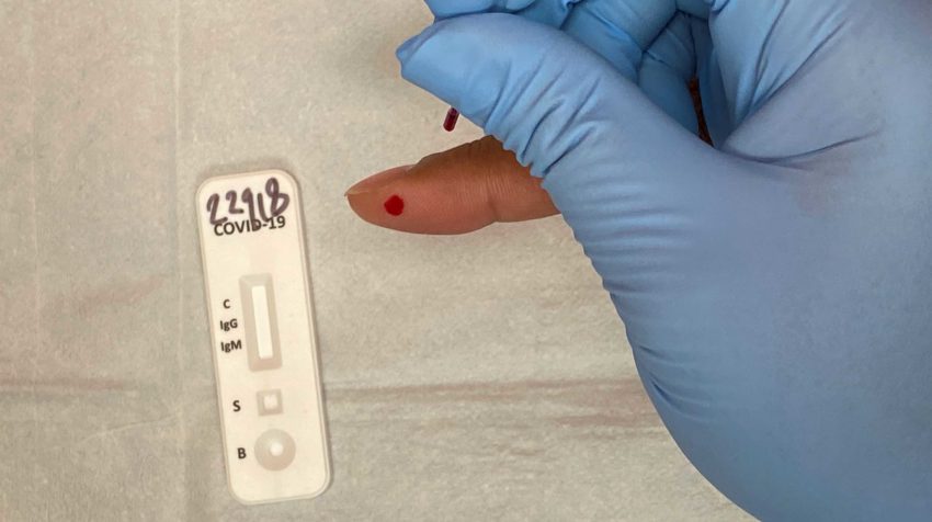 En Richmond, Texas, se aplica una prueba rápida de coronavirus para anticuerpos el 24 de abril de 2020.