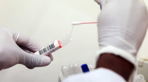 Las pruebas PCR para detectar el coronavirus se hacen con un raspado en la nariz o garganta y se usan reactivos para su confirmación..