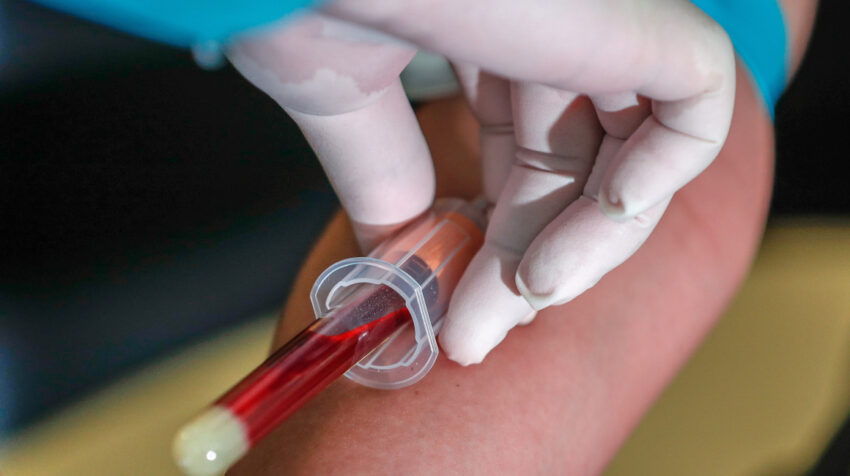 Un enfermero realiza un test de coronavirus en Manila, el 8 de julio de 2020.