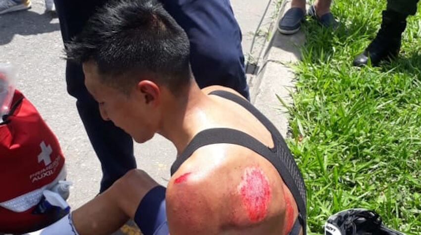 El ciclista Henry Velasco sufrió una fractura en la clavícula izquierda, luego de una caída, en la Etapa 1 de la Vuelta a Colombia.