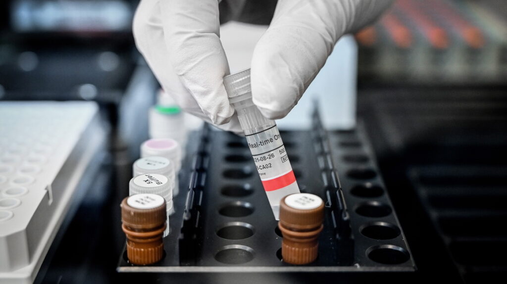 OMS inicia ensayos con tres nuevos posibles tratamientos contra Covid-19