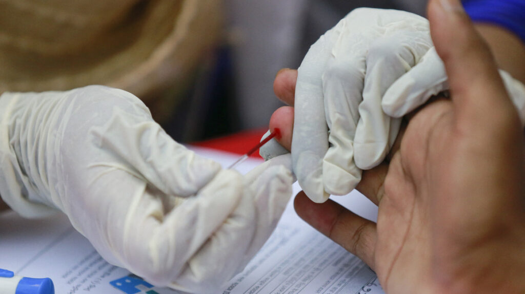 Moderna empieza los ensayos de una vacuna contra el VIH usando mRNA