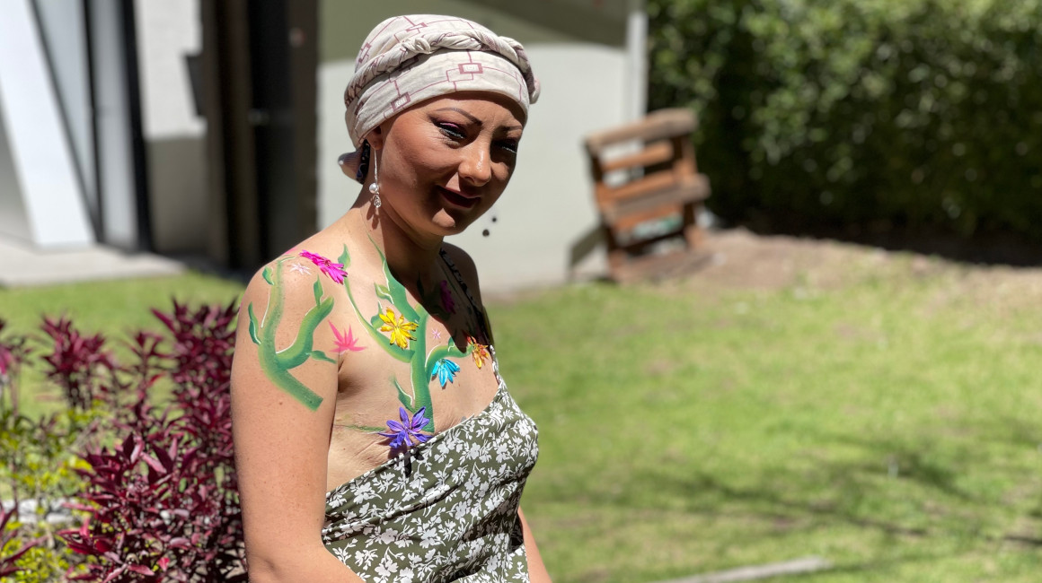 Natali Moya, de 37 años, asegura que necesita la radioterapia. 