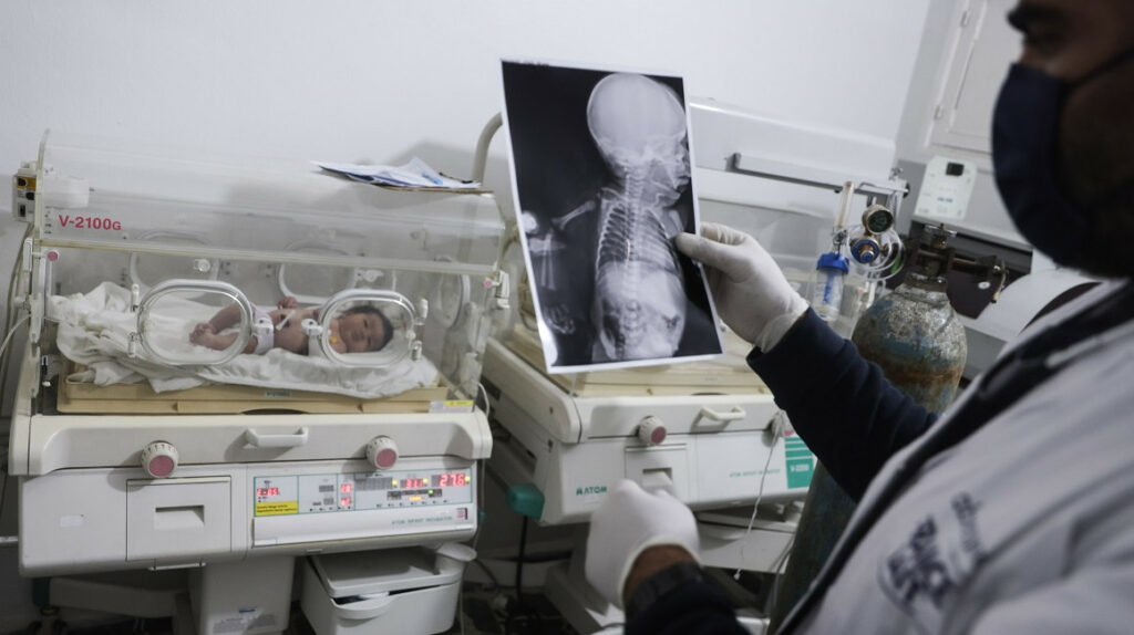 Terremoto: ‘Bebé milagrosa’ se recupera con éxito en Siria