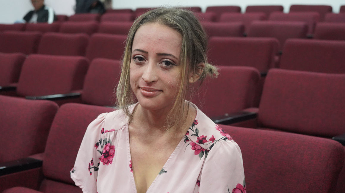 Isabel López, quien tiene dermatitis atópica, durante una entrevista en Quito, el 19 de julio de 2023.