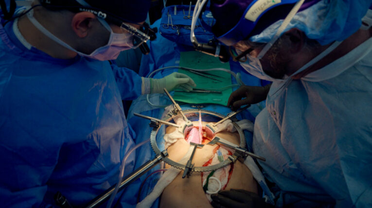 Médicos durante el trasplante de un riño de cerdo a un paciente con muerte cerebral, el 14 de julio de 2023. 