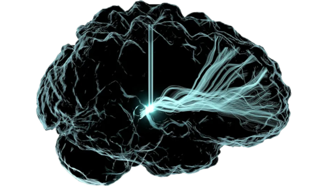 Atlas del cerebro humano
